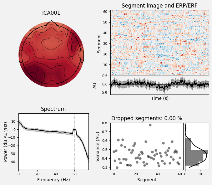 _images/train_network_eeg_1_391.png