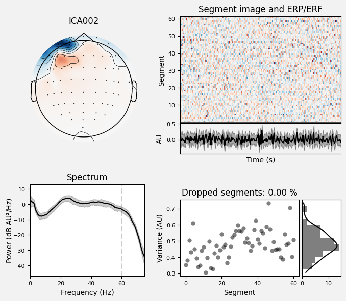 _images/train_network_eeg_1_392.png