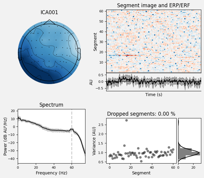 _images/train_network_eeg_1_396.png