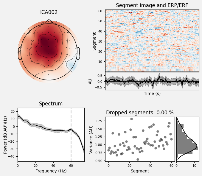 _images/train_network_eeg_1_397.png