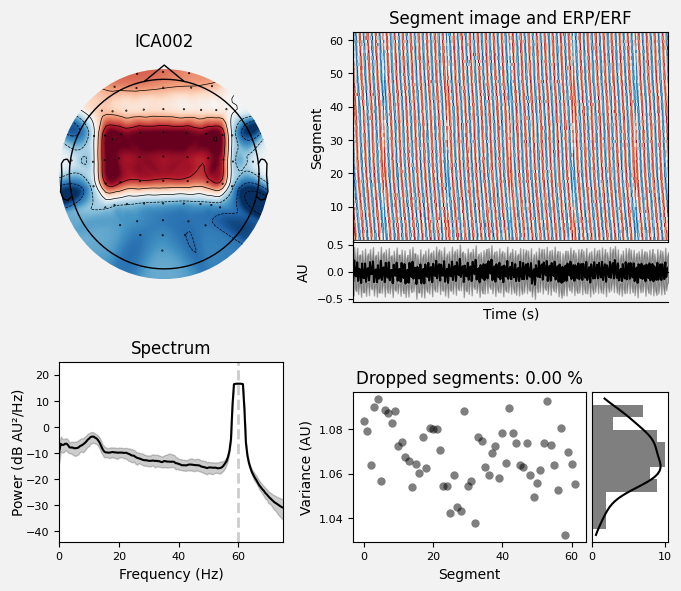 _images/train_network_eeg_1_40.png