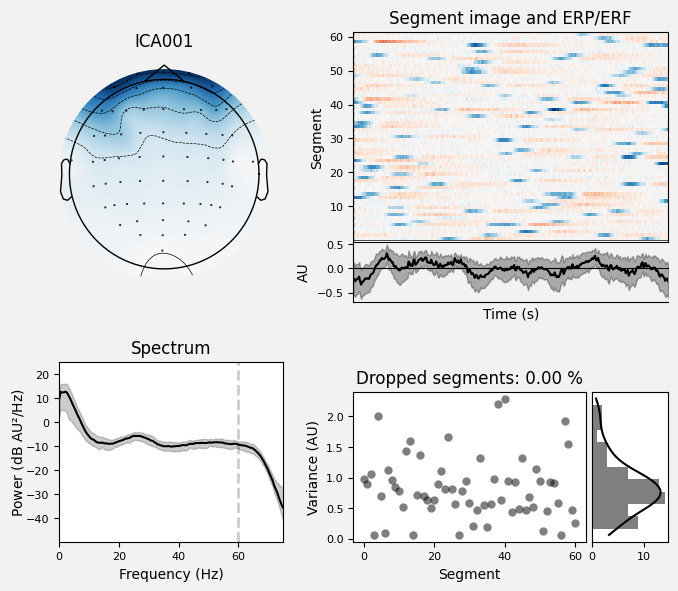 _images/train_network_eeg_1_403.png