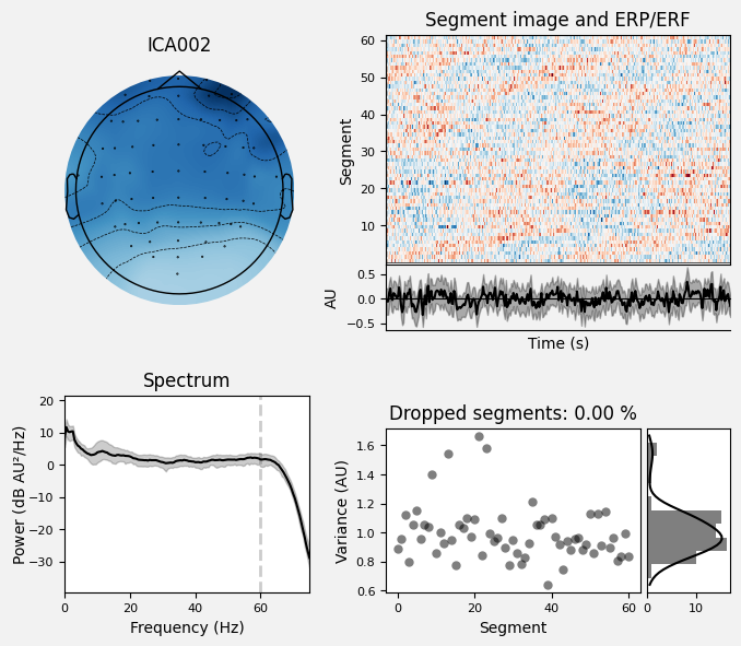 _images/train_network_eeg_1_404.png