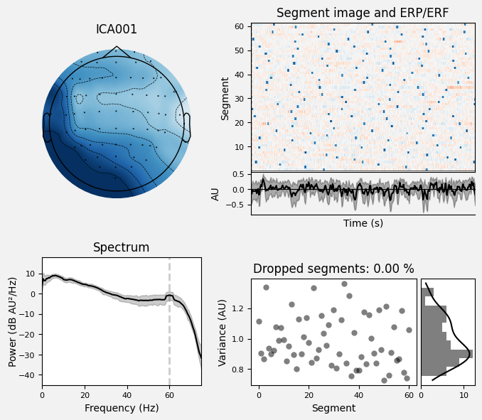 _images/train_network_eeg_1_408.png