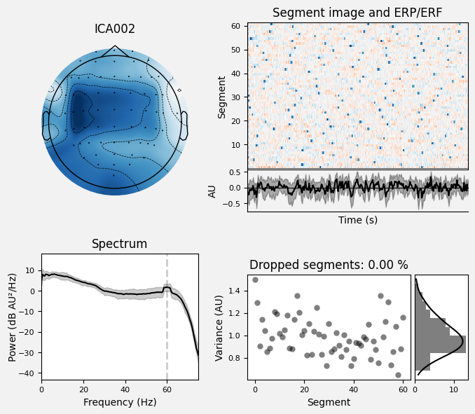 _images/train_network_eeg_1_409.png