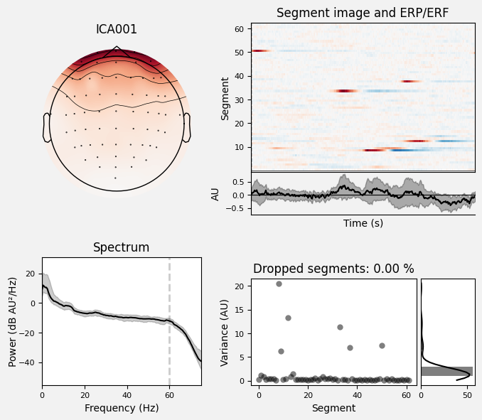 _images/train_network_eeg_1_413.png