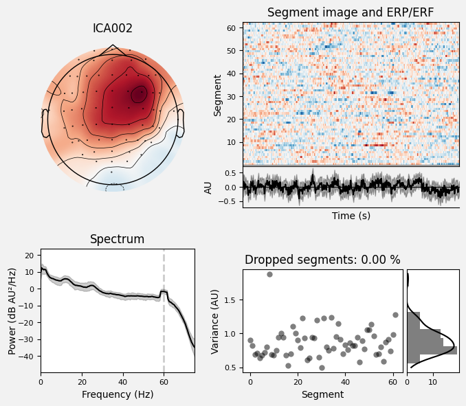 _images/train_network_eeg_1_414.png