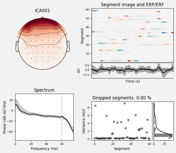 _images/train_network_eeg_1_418.png