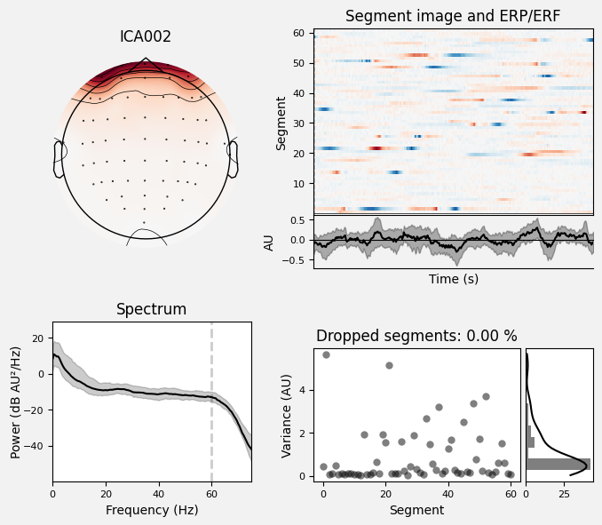 _images/train_network_eeg_1_419.png