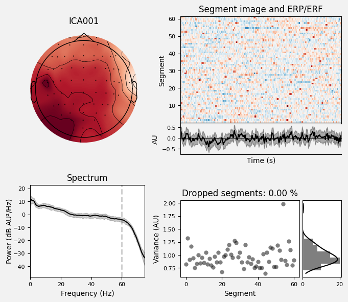_images/train_network_eeg_1_423.png