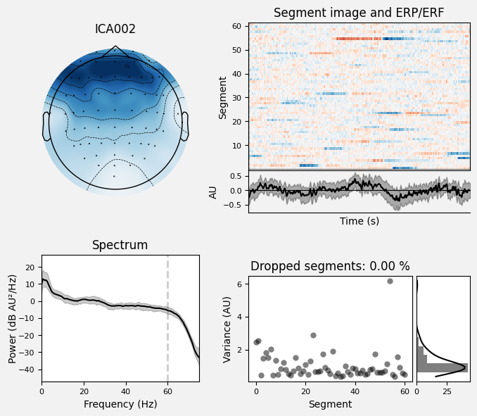 _images/train_network_eeg_1_424.png