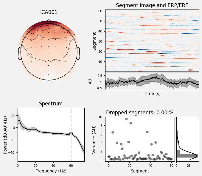 _images/train_network_eeg_1_428.png
