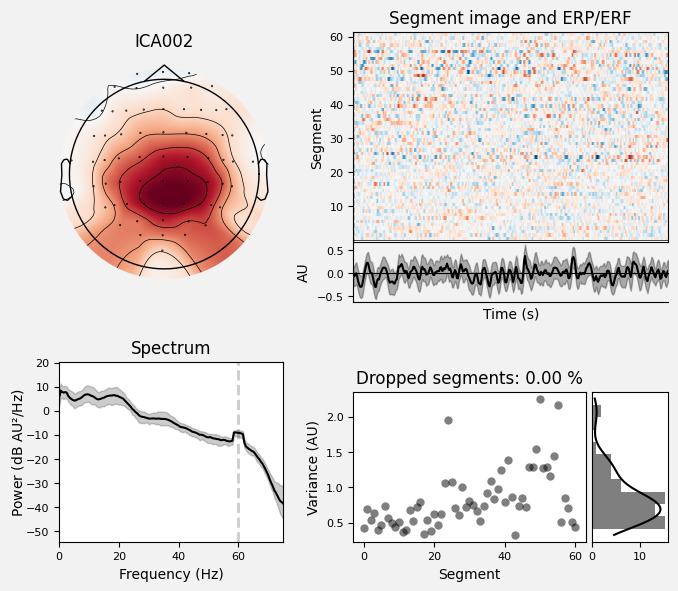 _images/train_network_eeg_1_429.png