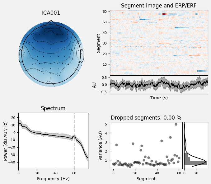 _images/train_network_eeg_1_433.png