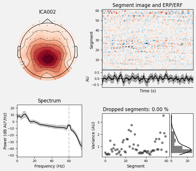 _images/train_network_eeg_1_434.png
