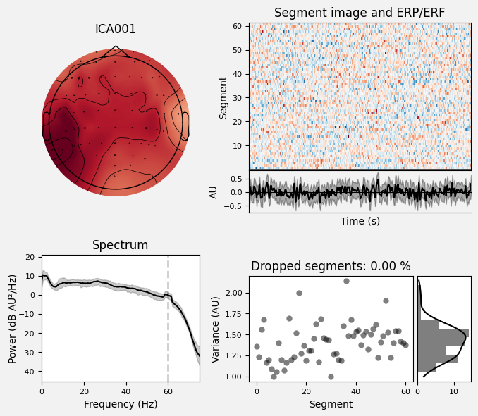 _images/train_network_eeg_1_438.png