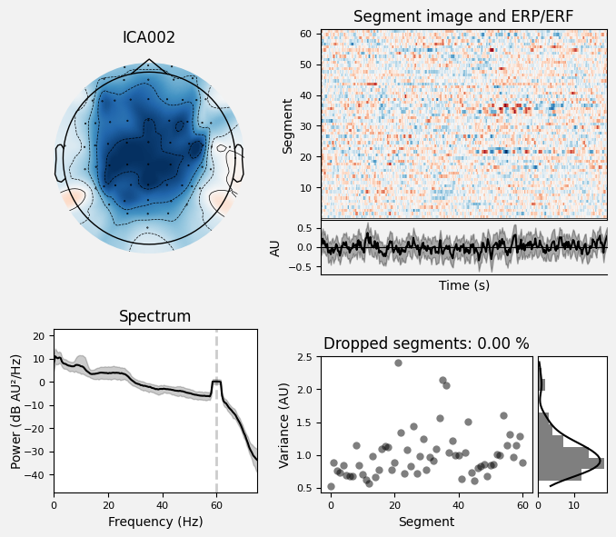 _images/train_network_eeg_1_439.png