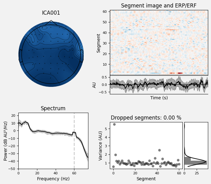 _images/train_network_eeg_1_44.png