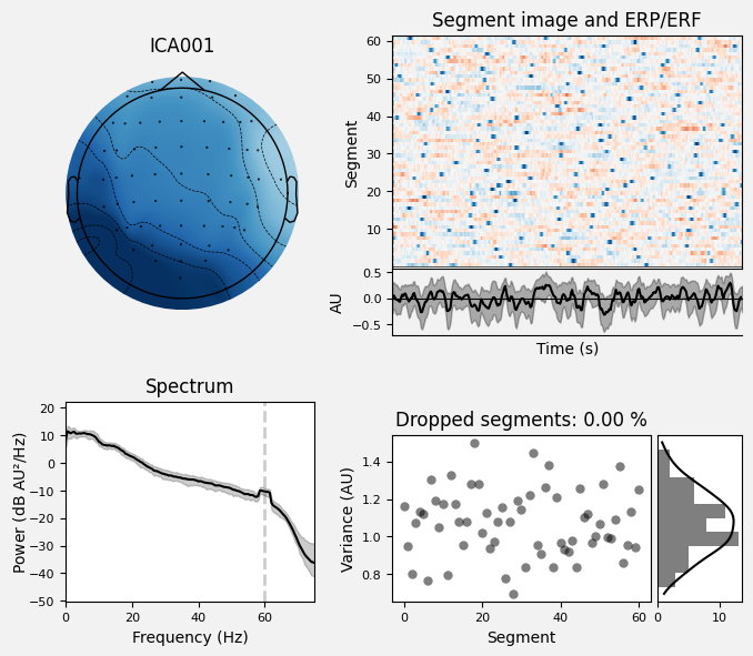 _images/train_network_eeg_1_443.png