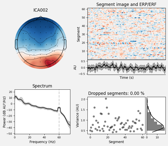 _images/train_network_eeg_1_444.png