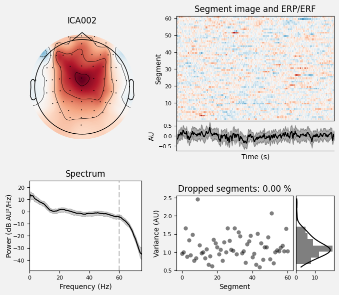 _images/train_network_eeg_1_45.png