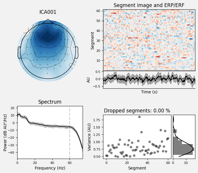 _images/train_network_eeg_1_452.png