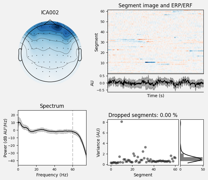_images/train_network_eeg_1_453.png