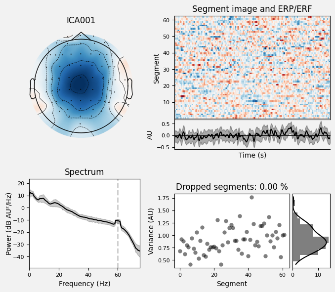 _images/train_network_eeg_1_457.png
