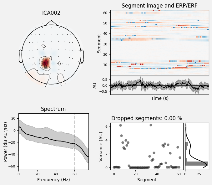 _images/train_network_eeg_1_458.png