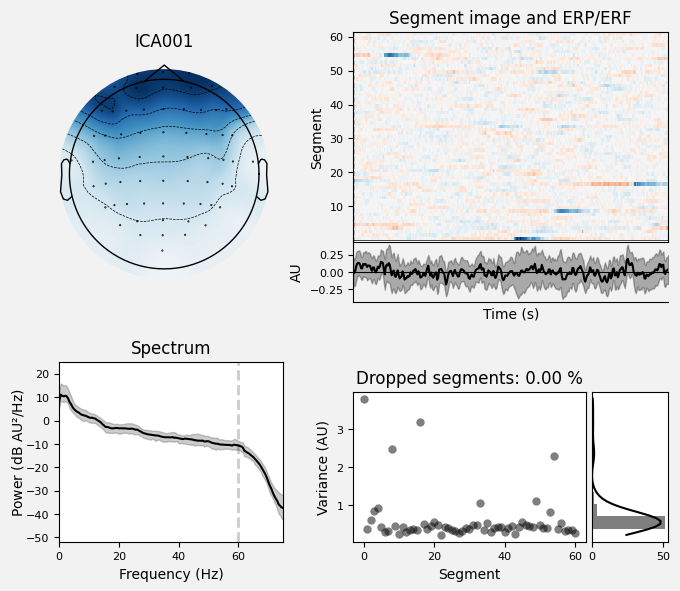 _images/train_network_eeg_1_464.png
