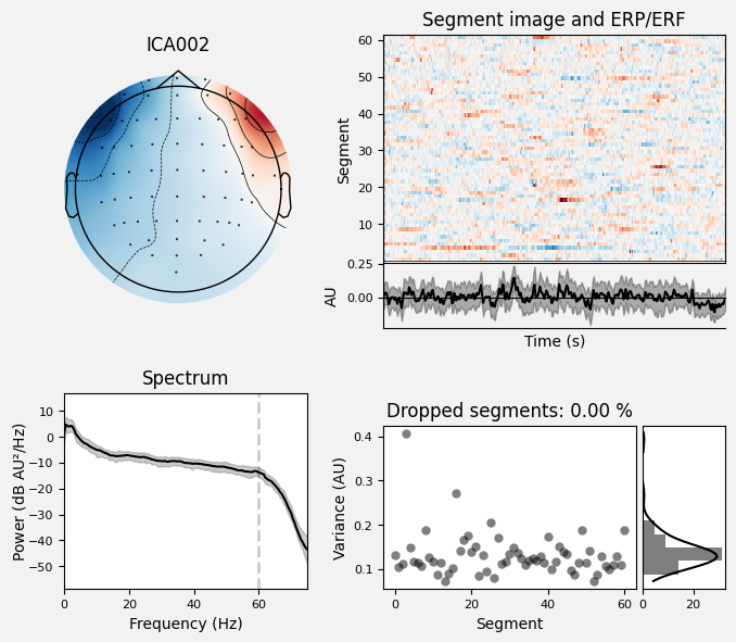 _images/train_network_eeg_1_465.png