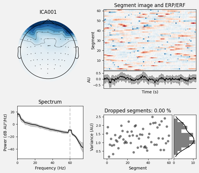 _images/train_network_eeg_1_471.png