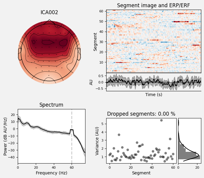 _images/train_network_eeg_1_472.png