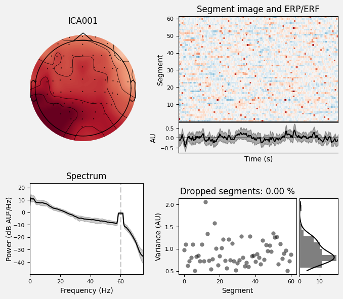 _images/train_network_eeg_1_476.png