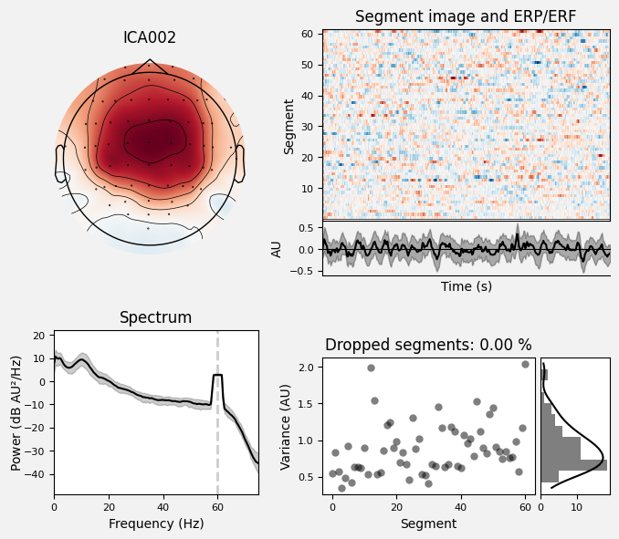 _images/train_network_eeg_1_477.png