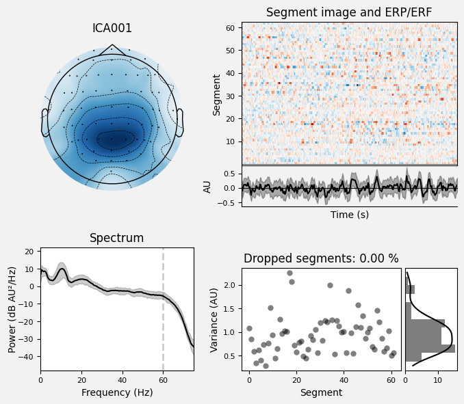 _images/train_network_eeg_1_481.png