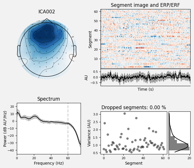_images/train_network_eeg_1_482.png