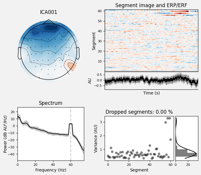 _images/train_network_eeg_1_488.png