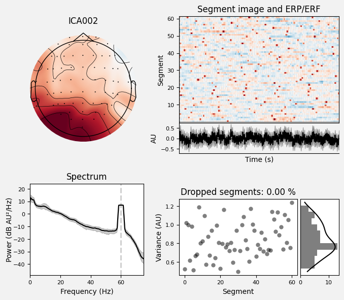 _images/train_network_eeg_1_489.png