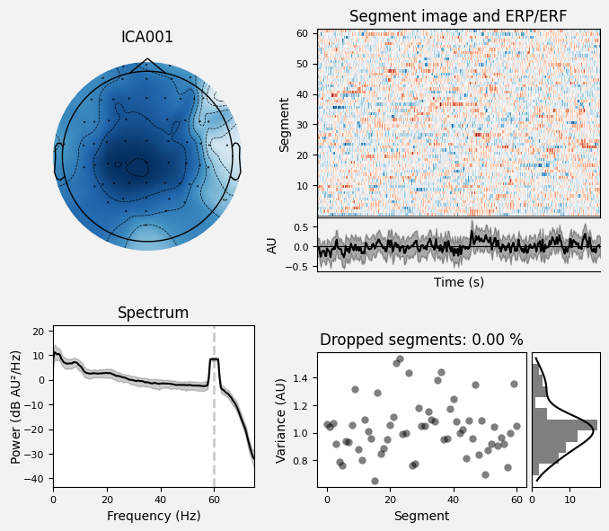 _images/train_network_eeg_1_49.png