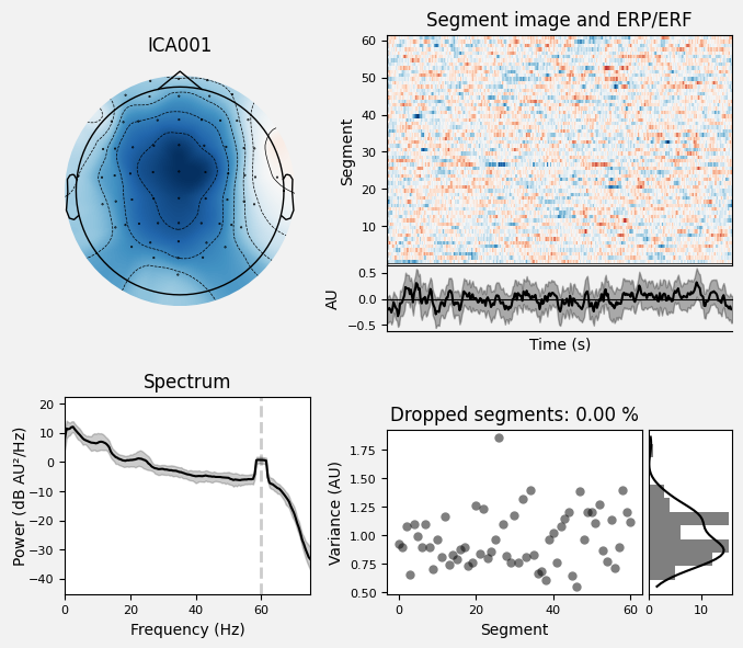 _images/train_network_eeg_1_493.png