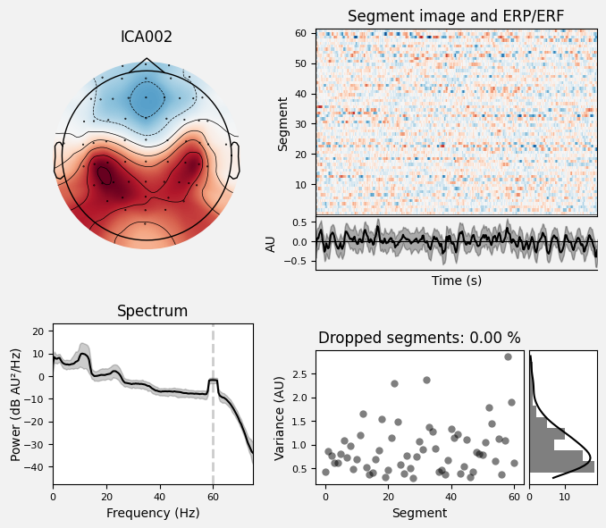 _images/train_network_eeg_1_494.png