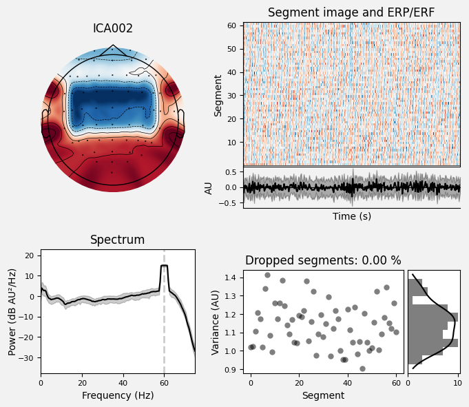 _images/train_network_eeg_1_50.png