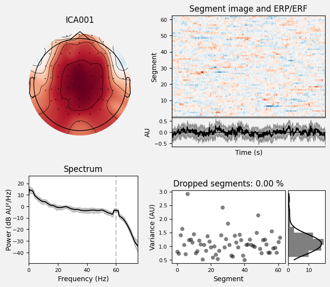 _images/train_network_eeg_1_500.png