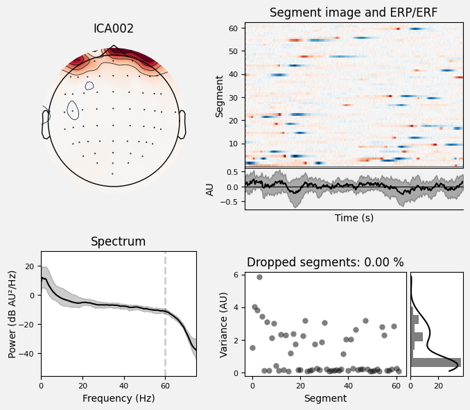 _images/train_network_eeg_1_501.png