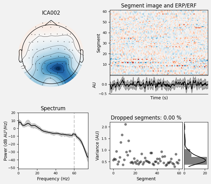 _images/train_network_eeg_1_508.png