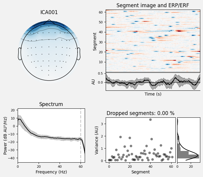 _images/train_network_eeg_1_514.png