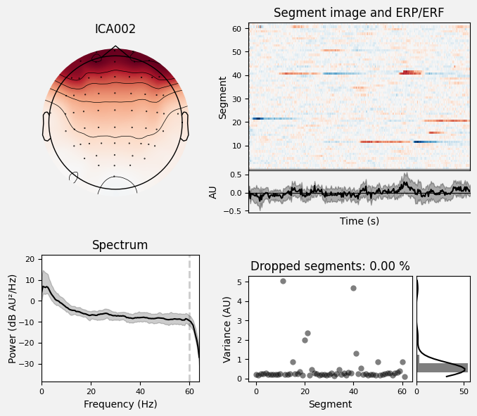 _images/train_network_eeg_1_515.png