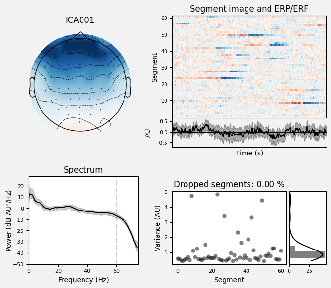 _images/train_network_eeg_1_521.png