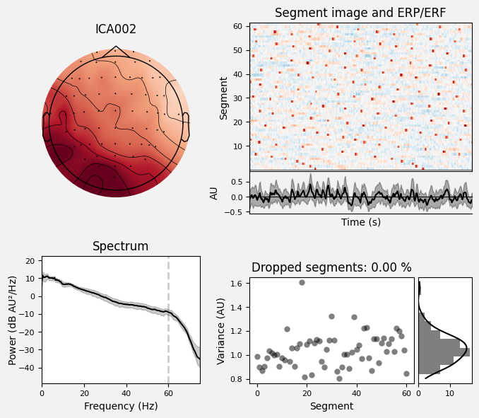 _images/train_network_eeg_1_522.png